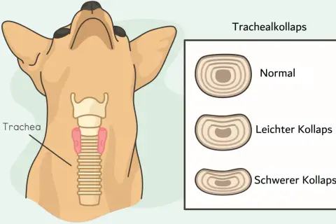 Illustration zeigt einen Hundehals mit Trachea und Lunge. Daneben Querschnitte der Trachea: normal, leichter und schwerer Kollaps. Trachealkollaps hund hausmittel.