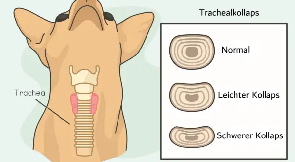Illustration zeigt einen Hundehals mit Trachea und Lunge. Daneben Querschnitte der Trachea: normal, leichter und schwerer Kollaps. Trachealkollaps hund hausmittel.