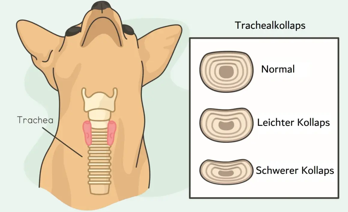 Illustration zeigt einen Hundehals mit Trachea und Lunge. Daneben Querschnitte der Trachea: normal, leichter und schwerer Kollaps. Trachealkollaps hund hausmittel.